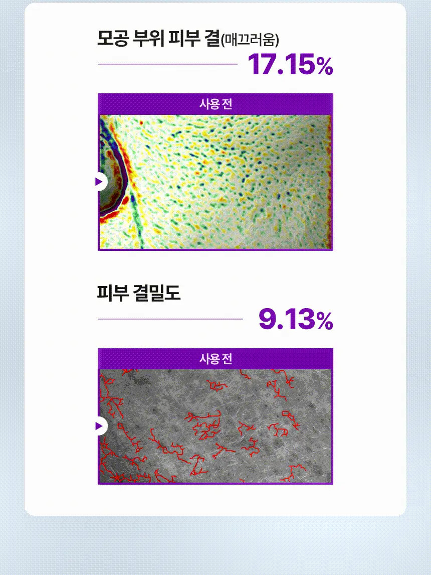 [NEW 탄력스피큘] 앰플엔 하이퍼샷 펩타이드 앰플 50ml 상세페이지 25